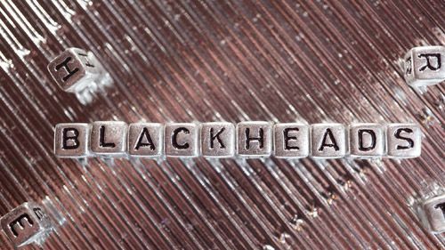 Blackheads: Treating Blackheads and Home Remedies
