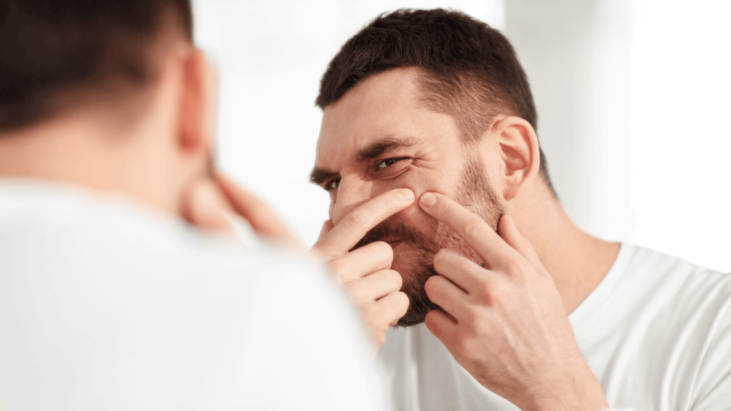 How To Get Rid Of Masturbation Pimples | Man Matters