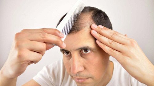 5 reasons your hair is falling out | Man Matters