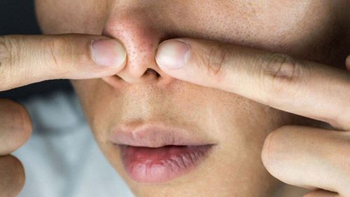  How To Get Rid Of Pimples On Nose Causes Cure More