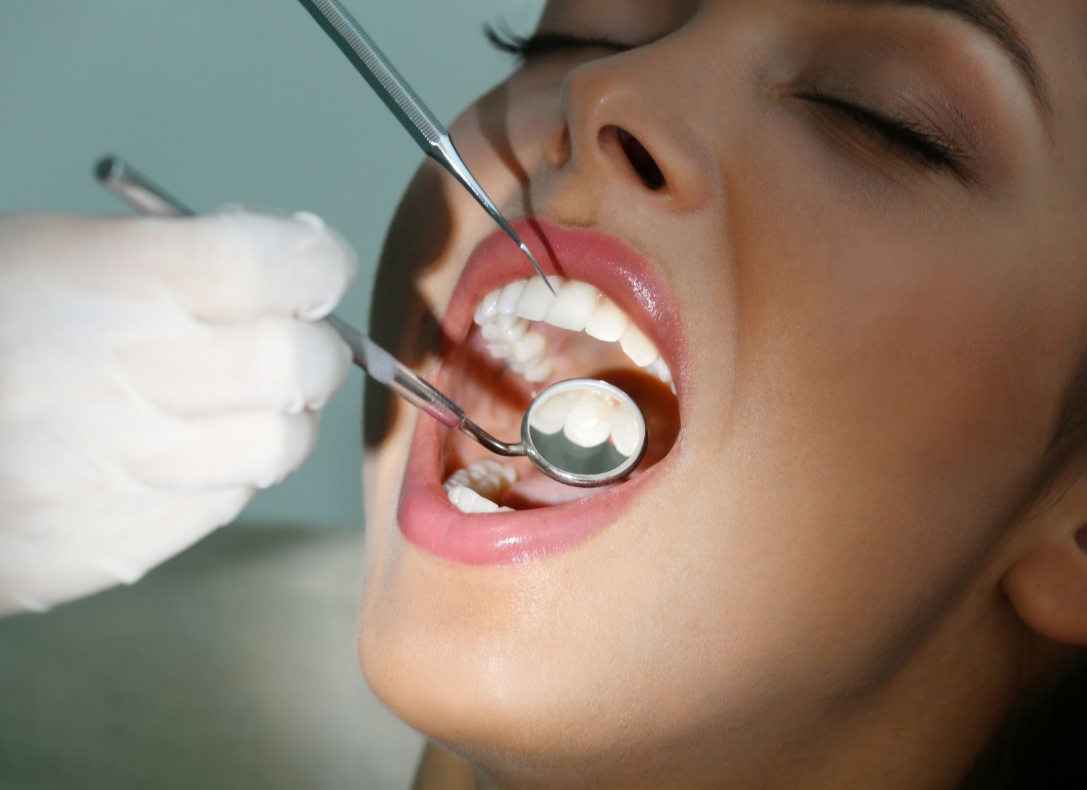 Black Spot On Tooth Causes Prevention Treatment