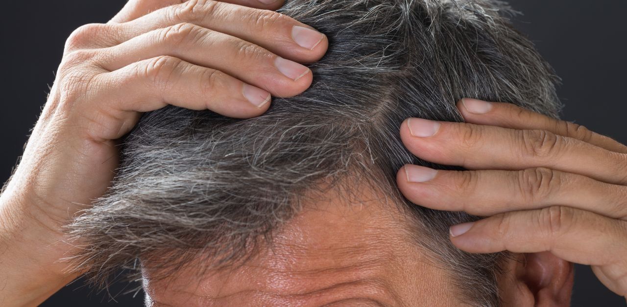How To Stop White Hair? (11 Effective Methods) - Drug Research