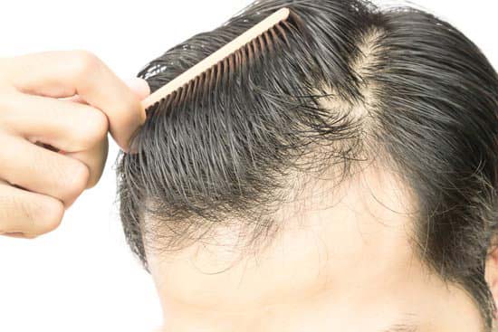 25 Ways to prevent hair loss for men