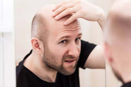Balding: Can Hair Grow Back After Balding?