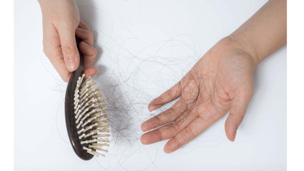 What Is Seborrheic Dermatitis? Does It Cause Hair Loss?