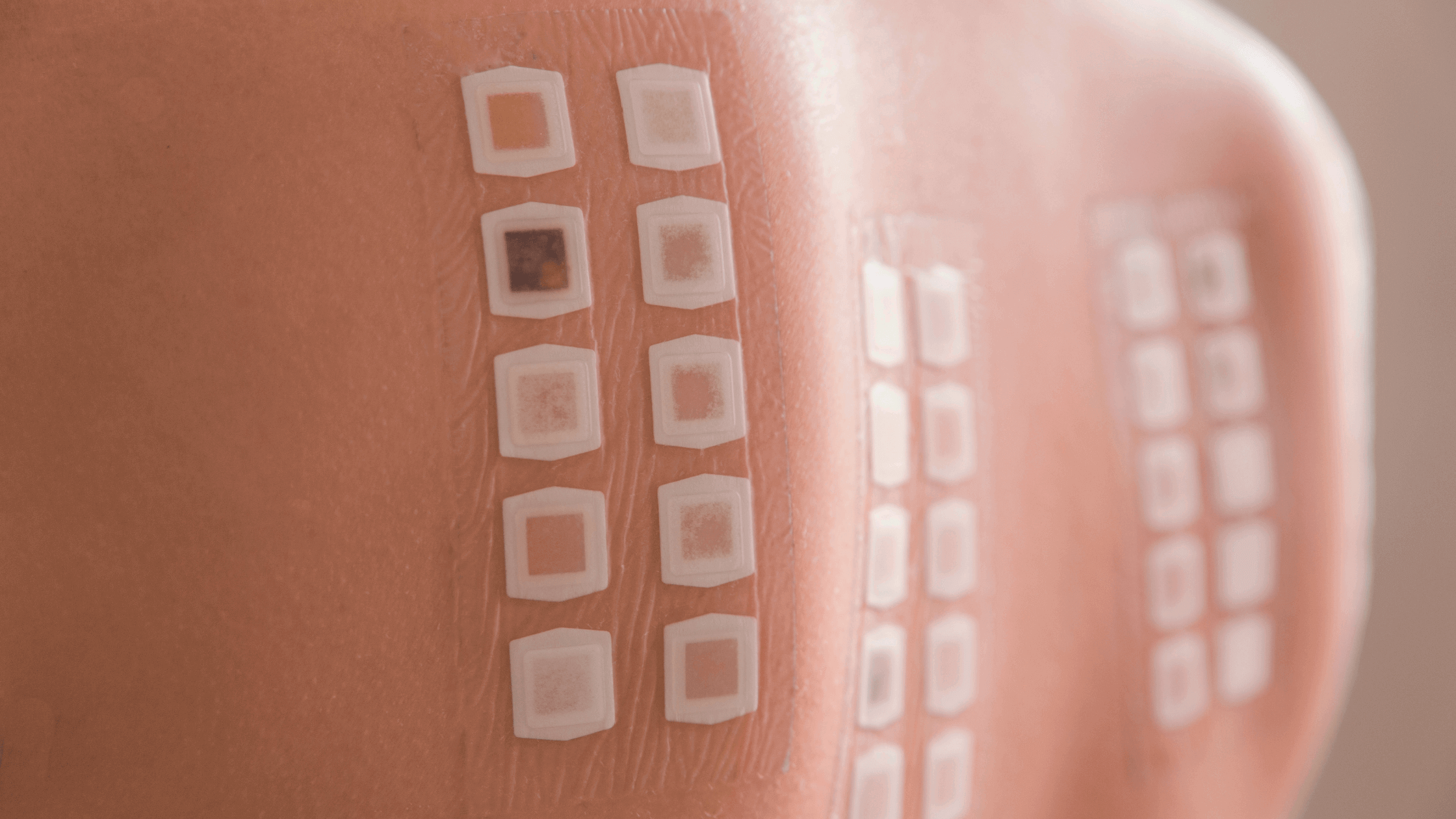 what-is-a-patch-test-and-how-is-it-done-know-all-about-patch-test