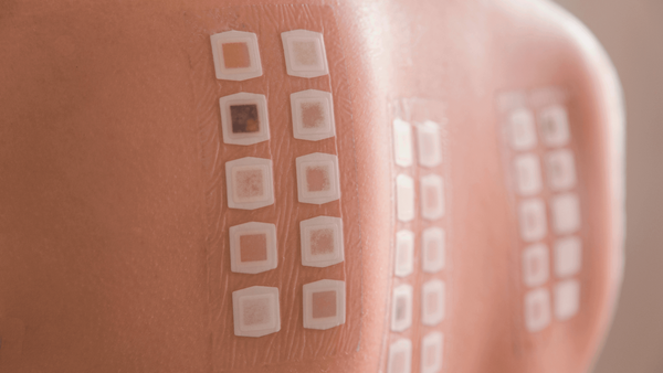 What Is A Patch Test And How Is It Done? | Know All About Patch Test